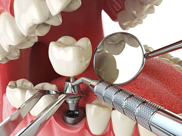 Best Broken or Chipped Tooth Repair in Kinston, NC